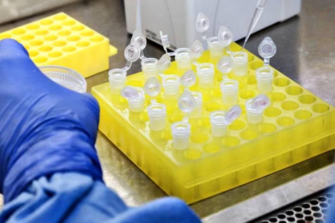Administração de Rio do Sul adquire dois mil testes rápidos para coronavírus