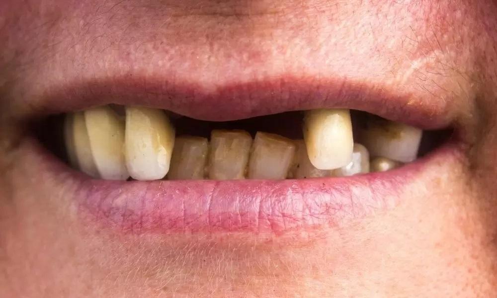 “Banguela” tenta assaltar padaria e funcionária impede e põe o ladrão para correr