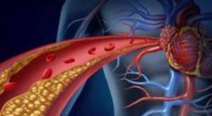 Frio do inverno aumenta o número de casos de infarto e Acidente Vascular Cerebral (AVC)