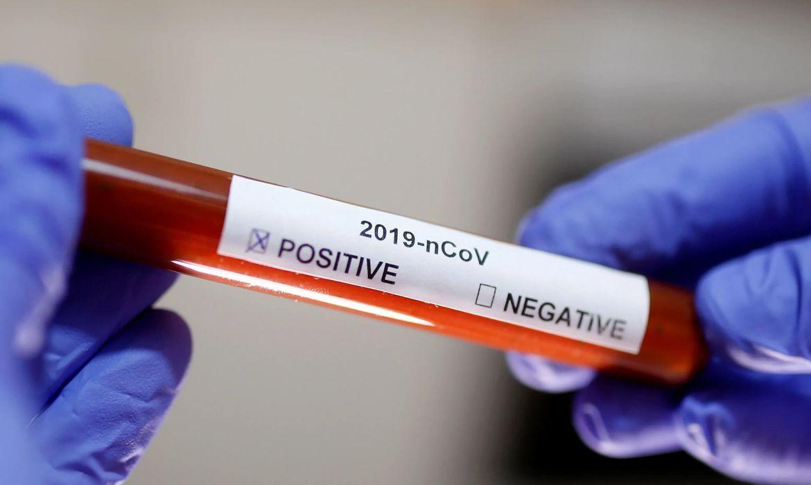 Leoberto Leal confirma primeiro caso positivo para COVID-19 na cidade