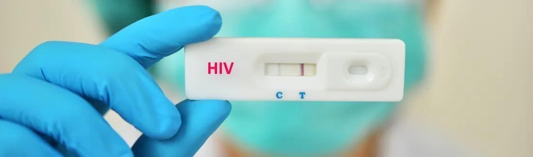 Médico esclarece: HIV não tratado pode se tornar AIDS