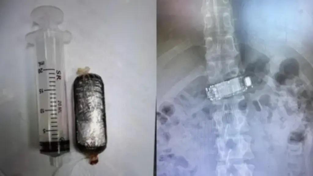 Preso engole celular em Rio do Sul e precisa ser levado ao hospital
