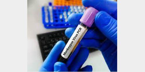 Primeiro lote de vacinas contra a varíola dos macacos chega ao Brasil 