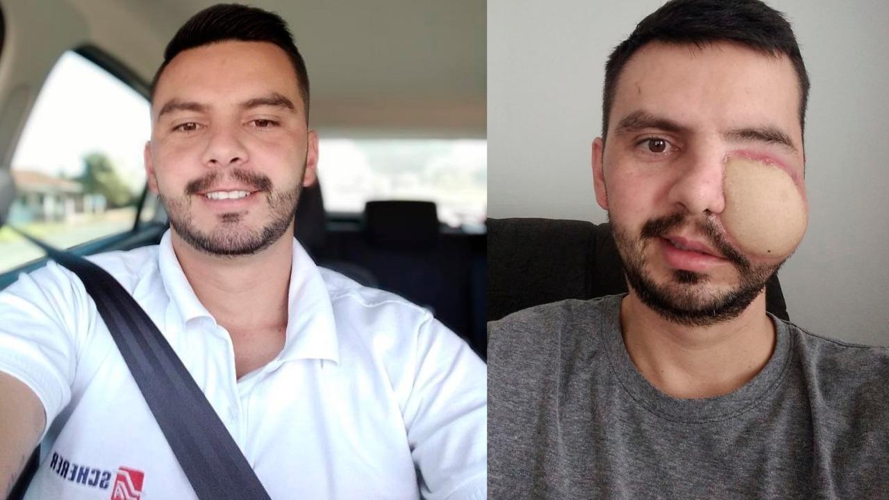 Sorteio da Ação Entre Amigos em prol do tratamento de Cleiton Foster foi realizado no fim de semana