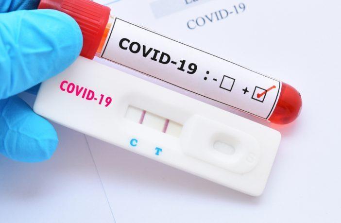 Trabalhadores de empresas de Ituporanga serão testados para COVID-19